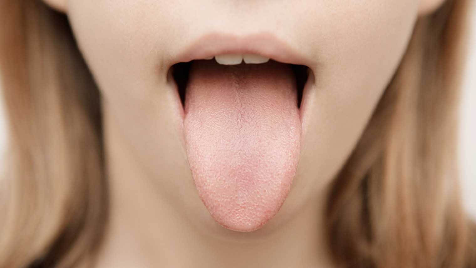 舌みがきで口臭予防!正しい舌苔の取り方7つのポイント