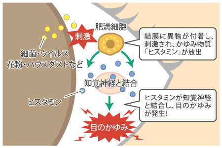 「目のかゆみ」はどうして起こるの?